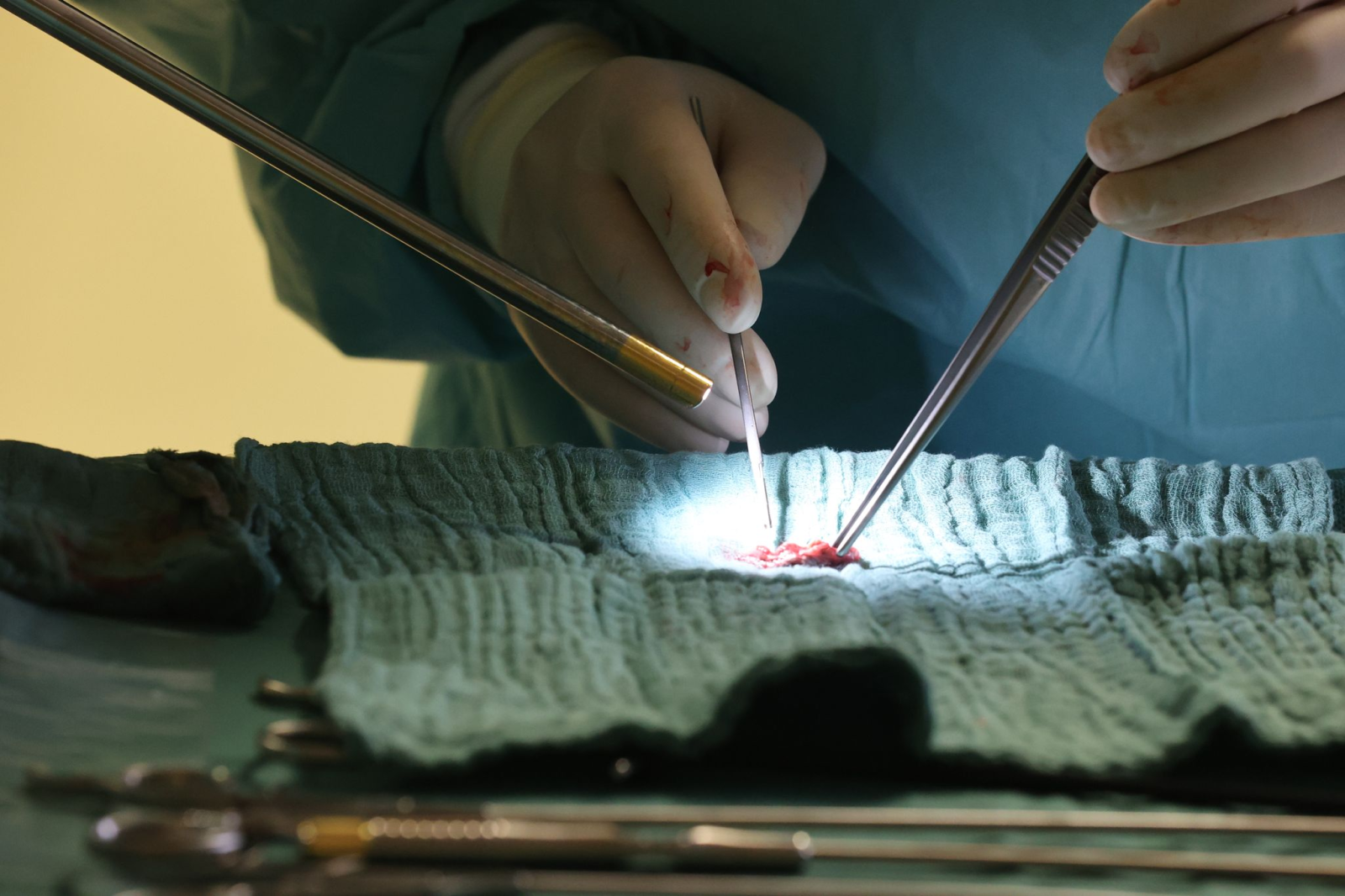 Ein Arzt steht bei einer endoskopischen Operation in einem Operationssaal im SRH Waldklinikum.
