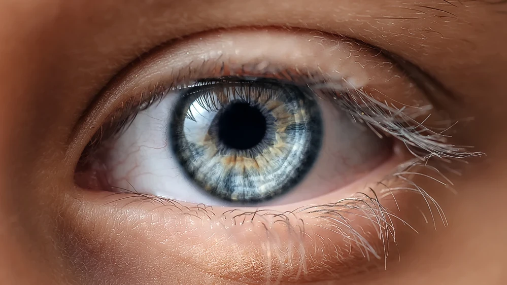 Göz Rengini Değiştirme Ameliyatı: Yeni ve Riskli Trend, © shutterstock Göz Rengini Değiştirme Ameliyatı: Yeni ve Riskli Trend, © shutterstock