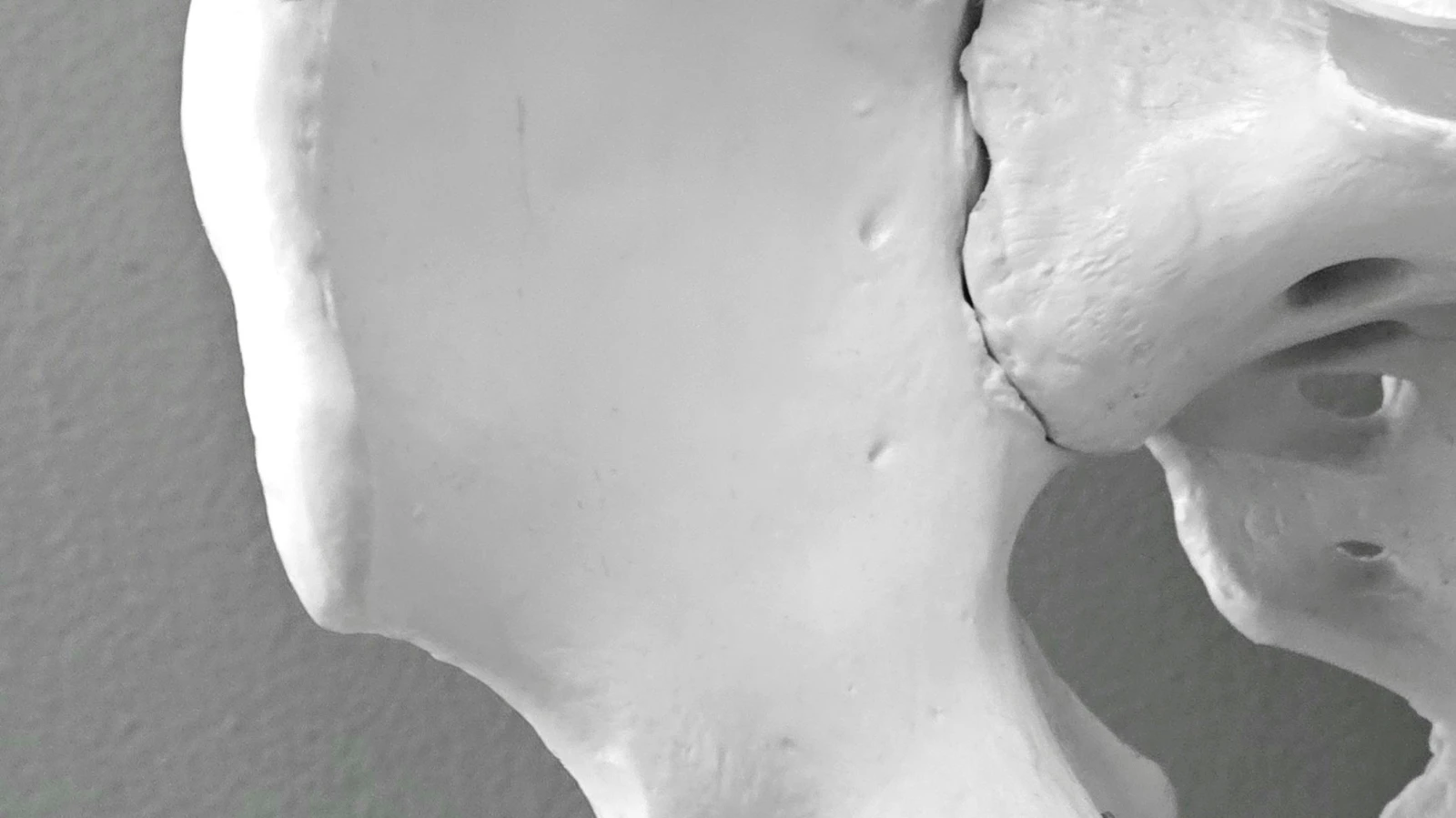 Thementag mit der Rheumaliga und dem Bethesda Spital: Wenn die Knochen still zerbrechen, © Magda Ehlers Thementag mit der Rheumaliga und dem Bethesda Spital: Wenn die Knochen still zerbrechen, © Magda Ehlers