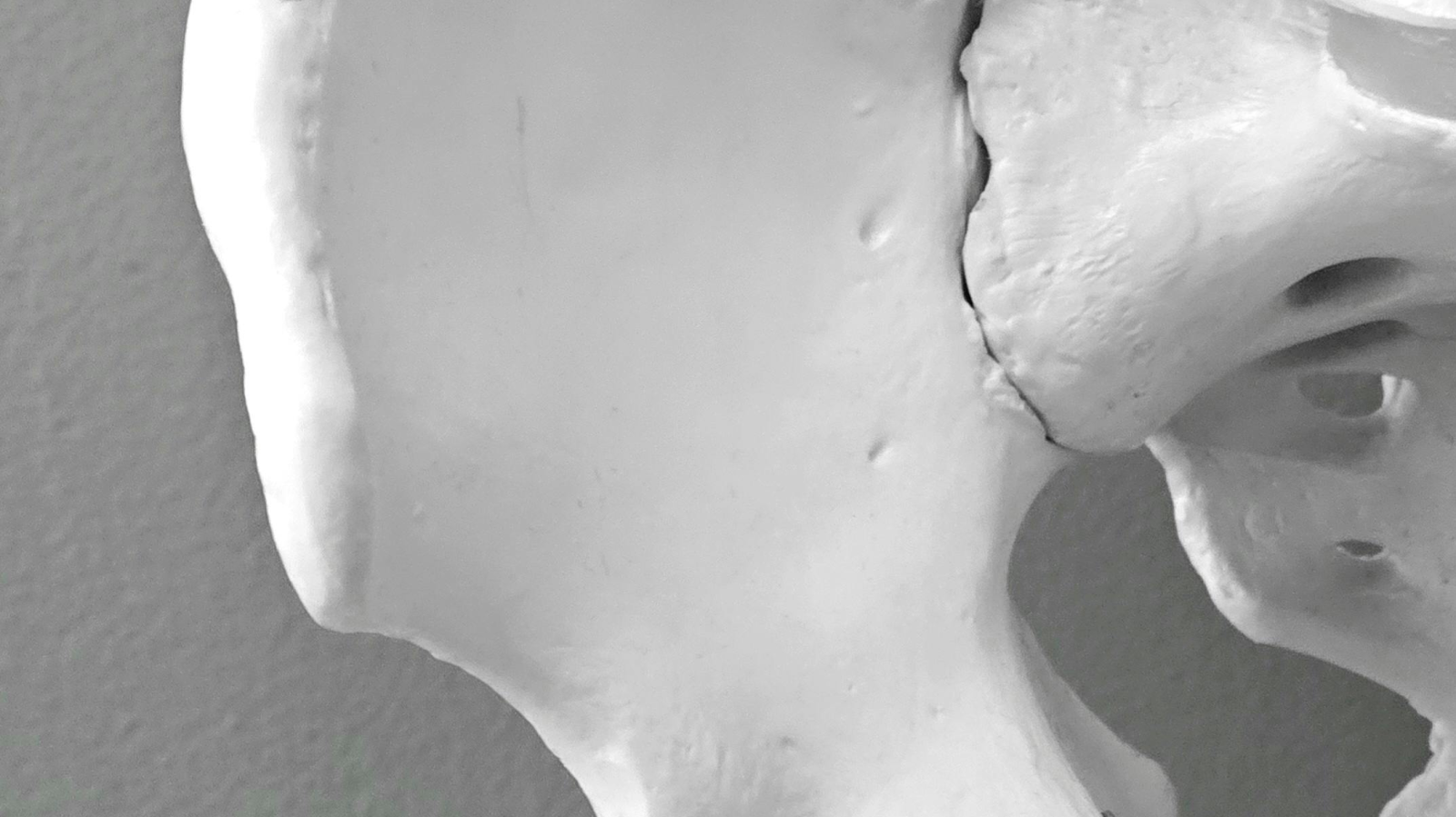 Thementag mit der Rheumaliga und dem Bethesda Spital: Wenn die Knochen still zerbrechen, © Magda Ehlers