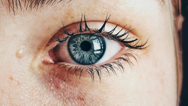 Was hilft bei entzündeten Augen?, © Almada Studio Was hilft bei entzündeten Augen?, © Almada Studio