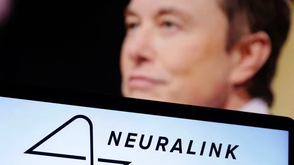 Neuralink, ABD'den Resmen Onay Aldı: Beyin Çipi, Yakında İkinci Hastaya Yerleştirilecek, © shutterstock Neuralink, ABD'den Resmen Onay Aldı: Beyin Çipi, Yakında İkinci Hastaya Yerleştirilecek, © shutterstock