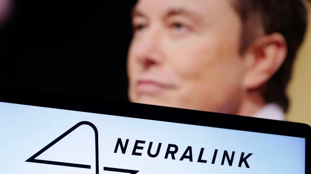 Neuralink, ABD'den Resmen Onay Aldı: Beyin Çipi, Yakında İkinci Hastaya Yerleştirilecek, © shutterstock