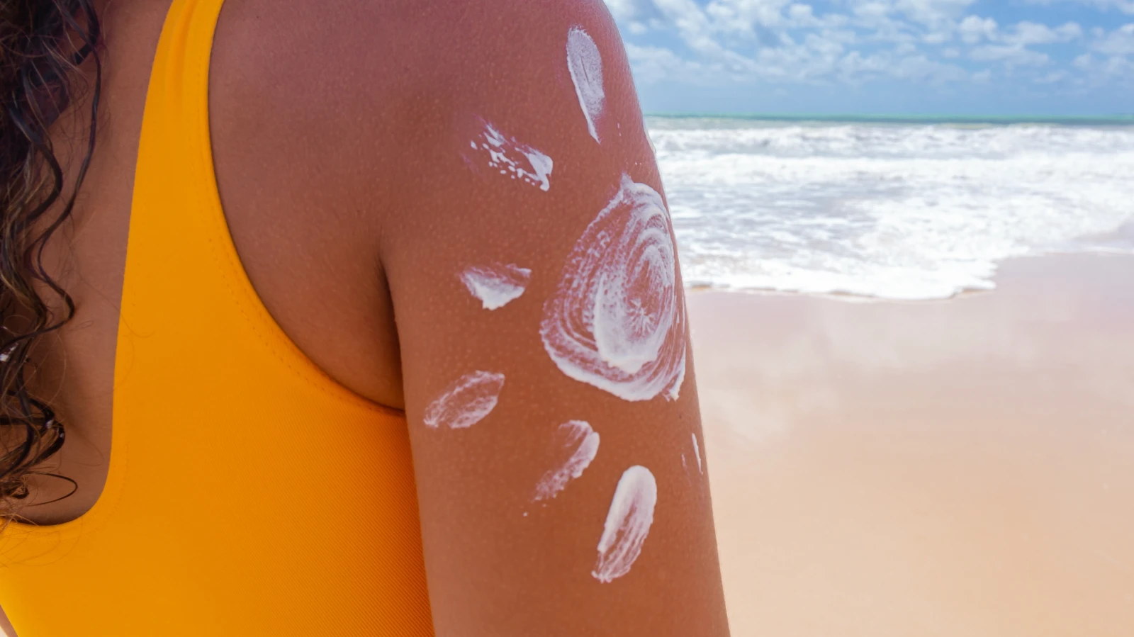 Siyah deri kanseri Hessen’de en sık görülen türlerden biri, © shutterstock Siyah deri kanseri Hessen’de en sık görülen türlerden biri, © shutterstock