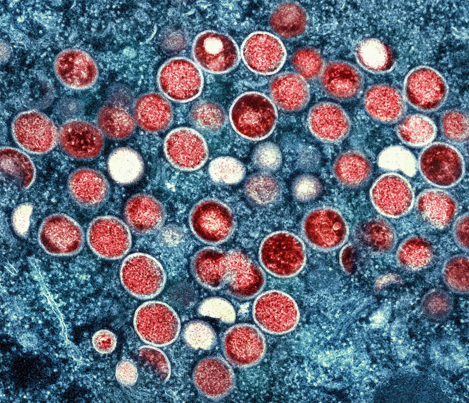 Eine Aufnahme von Partikeln des Affenpockenvirus (rot) in einer infizierten Zelle (blau).