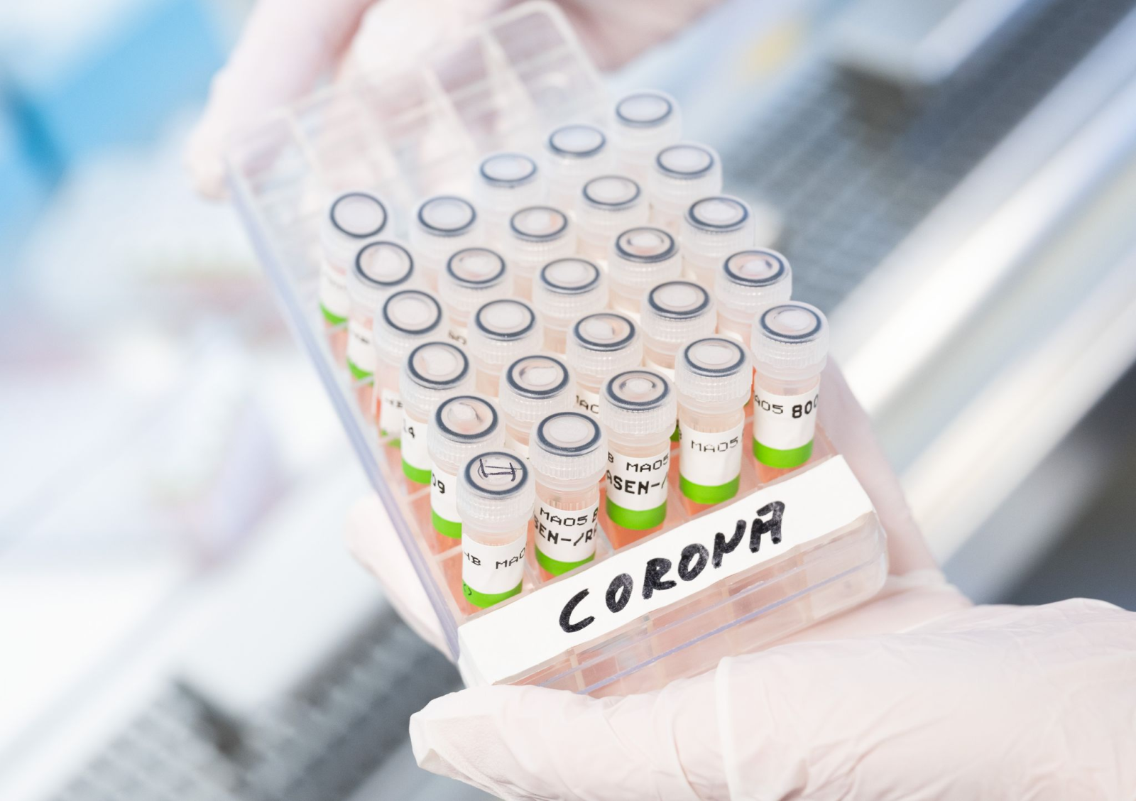 Eine biologisch-technische Assistentin hält ein Gefäß mit aufbereiteten PCR-Tests auf das Coronavirus in der Hand.