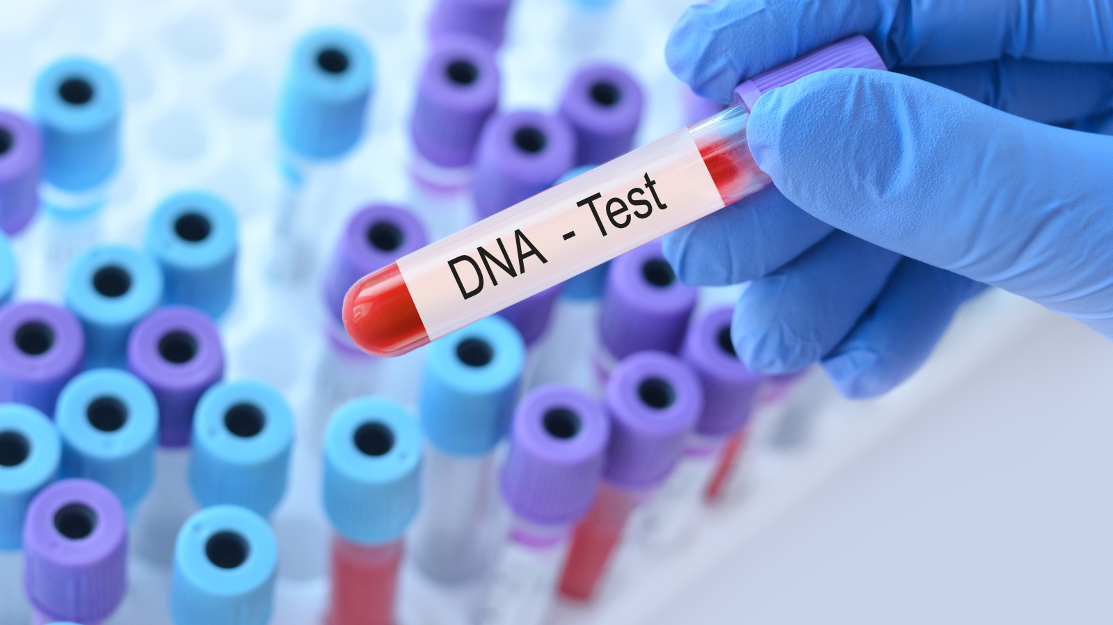 Darmstadt: Polis Katili DNA Testiyle Arıyor, © shutterstock