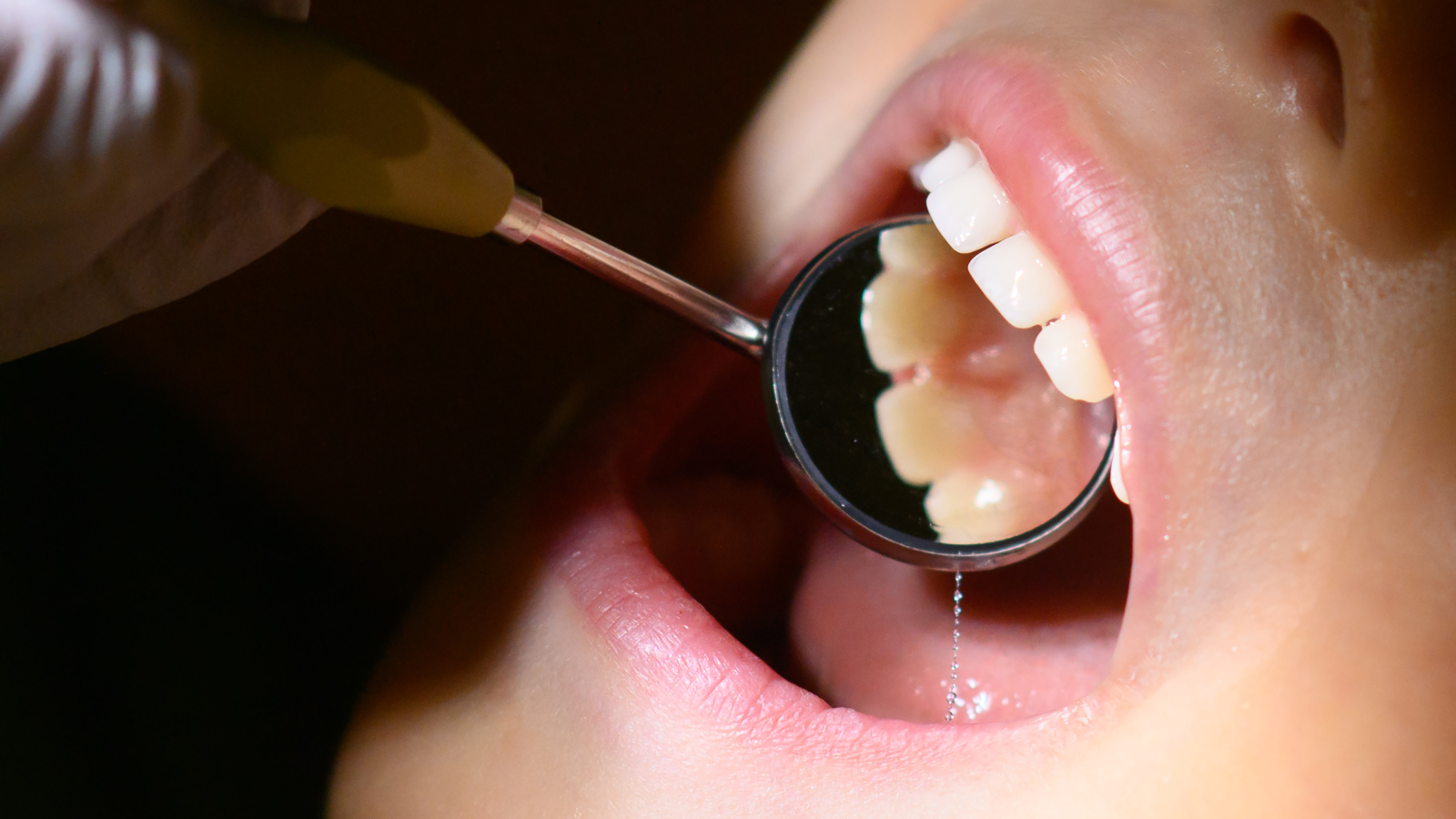 Çocuk Ölümüne neden Olduğu Gerekçesiyle Anestezi Uzmanı Yargılanıyor!, © dpa