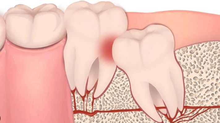 © zahn.ch © zahn.ch