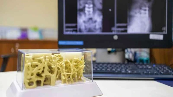 Präventiv etwas tun gegen Osteoporose, © zVg Bethesda Spital Präventiv etwas tun gegen Osteoporose, © zVg Bethesda Spital