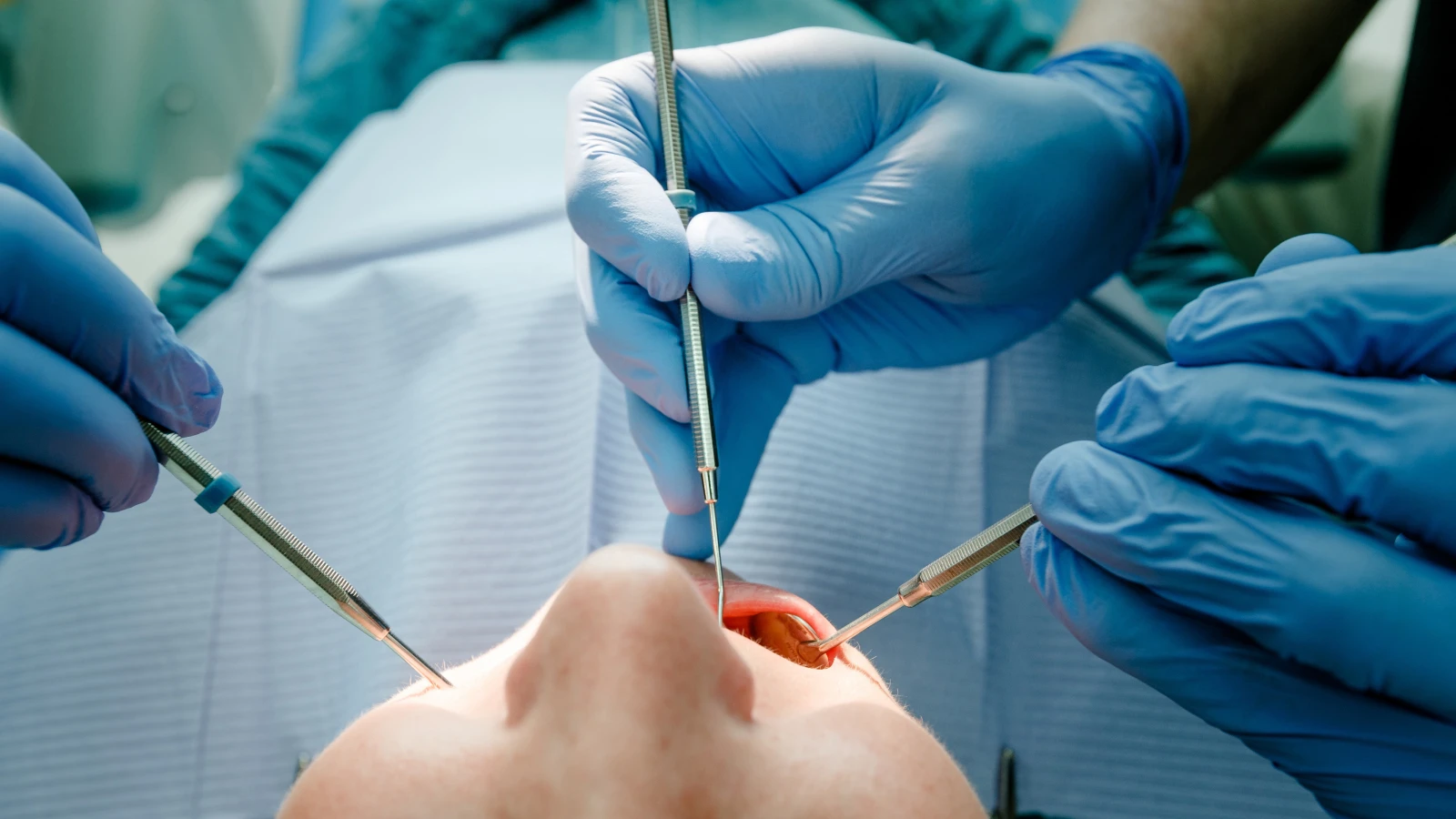 2025 Ocak ayından itibaren, amalgam dolguların diş hekimleri tarafından kullanılması, bazı istisnalar dışında, tamamen yasaklanacak. Avrupa Birliği’nin aldığı bu karar, amalgamın içeriğinde bulunan civa nedeniyle uygulamaya konuldu. Civa, dünyadaki en zehirli ağır metallerden biri olarak biliniyor. Ancak Bremen diş hekimleri, mevcut ve sağlam olan amalgam dolguların çıkarılmasının gerekli olmadığını vurguluyor. Amalgam Nedir ve Neden Yasaklanıyor? Amalgam, bakır, gümüş, kalay ve civa gibi metallerin bir karışımıdır. Özellikle 1990'lı yıllarda yaygın bir dolgu malzemesi olarak kullanılmıştır. Ancak civa içeriği nedeniyle sağlık riskleri taşıdlokaln1ığı düşünülüyor. Civanın Etkileri: Yorgunluk, eklem ağrıları ve genel huzursuzluk gibi belirtiler görülebilir. Mevcut Yasaklar: 2018’den beri amalgam dolgular, hamileler, emziren anneler, 15 yaş altı çocuklar ve böbrek hastaları için zaten yasaklanmıştı. 2025 itibarıyla bu yasak tüm gruplar için geçerli olacak. Sağlam Amalgam Dolgular Güvenli Bremen Diş Hekimleri Birliği Başkanı Martin Sztraka, sağlam ve işlevsel olan amalgam dolguların çıkarılmasına gerek olmadığını belirtiyor: "Amalgam dolguların çıkarılması sırasında civa salınımı riski bulunuyor. Bu yüzden sağlam dolguların yerinde kalması daha güvenlidir." Eğer hasta, sağlam bir amalgam dolgunun çıkarılmasını talep ederse, bu işlem sağlık sigortası kapsamına girmez ve masraflar hastanın kendisi tarafından karşılanır. Amalgam, şu anda sigorta tarafından tamamen karşılanan tek dolgu malzemesi olsa da, 2025’ten itibaren sigorta kapsamına basit plastik veya cam-çimento dolgular dahil edilecek. Amalgamın Azalan Kullanımı Amalgam dolgular, diş hekimliği uygulamalarında giderek daha az tercih ediliyor. 1995: Diş dolgularının %33'ünde amalgam kullanılıyordu. 2022: Bu oran %2,4’e düştü. Diş Hekimlerinden Tavsiyeler Diş hekimleri, amalgam dolgularının çıkarılması gerektiğinde bu işlemin dikkatli yapılması gerektiğini vurguluyor. Yanlış bir işlem civa salınımına yol açabilir. Ayrıca Bremen diş hekimleri, yeni düzenlemeyle artacak olan bürokrasi yükünün azaltılmasını talep ediyor. Yeni yasak, civa içeriği nedeniyle sağlık ve çevre koruması adına önemli bir adım olarak görülüyor. Ancak hastaların ve diş hekimlerinin bilinçli hareket etmeleri büyük önem taşıyor. Kaynak: buten un binnen , © dpa 2025 Ocak ayından itibaren, amalgam dolguların diş hekimleri tarafından kullanılması, bazı istisnalar dışında, tamamen yasaklanacak. Avrupa Birliği’nin aldığı bu karar, amalgamın içeriğinde bulunan civa nedeniyle uygulamaya konuldu. Civa, dünyadaki en zehirli ağır metallerden biri olarak biliniyor. Ancak Bremen diş hekimleri, mevcut ve sağlam olan amalgam dolguların çıkarılmasının gerekli olmadığını vurguluyor. Amalgam Nedir ve Neden Yasaklanıyor? Amalgam, bakır, gümüş, kalay ve civa gibi metallerin bir karışımıdır. Özellikle 1990'lı yıllarda yaygın bir dolgu malzemesi olarak kullanılmıştır. Ancak civa içeriği nedeniyle sağlık riskleri taşıdlokaln1ığı düşünülüyor. Civanın Etkileri: Yorgunluk, eklem ağrıları ve genel huzursuzluk gibi belirtiler görülebilir. Mevcut Yasaklar: 2018’den beri amalgam dolgular, hamileler, emziren anneler, 15 yaş altı çocuklar ve böbrek hastaları için zaten yasaklanmıştı. 2025 itibarıyla bu yasak tüm gruplar için geçerli olacak. Sağlam Amalgam Dolgular Güvenli Bremen Diş Hekimleri Birliği Başkanı Martin Sztraka, sağlam ve işlevsel olan amalgam dolguların çıkarılmasına gerek olmadığını belirtiyor: "Amalgam dolguların çıkarılması sırasında civa salınımı riski bulunuyor. Bu yüzden sağlam dolguların yerinde kalması daha güvenlidir." Eğer hasta, sağlam bir amalgam dolgunun çıkarılmasını talep ederse, bu işlem sağlık sigortası kapsamına girmez ve masraflar hastanın kendisi tarafından karşılanır. Amalgam, şu anda sigorta tarafından tamamen karşılanan tek dolgu malzemesi olsa da, 2025’ten itibaren sigorta kapsamına basit plastik veya cam-çimento dolgular dahil edilecek. Amalgamın Azalan Kullanımı Amalgam dolgular, diş hekimliği uygulamalarında giderek daha az tercih ediliyor. 1995: Diş dolgularının %33'ünde amalgam kullanılıyordu. 2022: Bu oran %2,4’e düştü. Diş Hekimlerinden Tavsiyeler Diş hekimleri, amalgam dolgularının çıkarılması gerektiğinde bu işlemin dikkatli yapılması gerektiğini vurguluyor. Yanlış bir işlem civa salınımına yol açabilir. Ayrıca Bremen diş hekimleri, yeni düzenlemeyle artacak olan bürokrasi yükünün azaltılmasını talep ediyor. Yeni yasak, civa içeriği nedeniyle sağlık ve çevre koruması adına önemli bir adım olarak görülüyor. Ancak hastaların ve diş hekimlerinin bilinçli hareket etmeleri büyük önem taşıyor. Kaynak: buten un binnen , © dpa