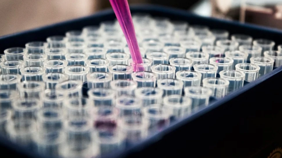 © Symbolbild: Unsplash, Louis Reed. © Symbolbild: Unsplash, Louis Reed.