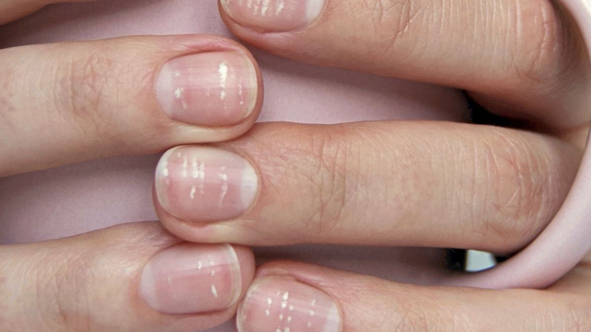 Tırnaklardan Yaşam Tarzı Okunabilir mi? Fulda’dan Dikkat Çeken Araştırma!, © aponet.de