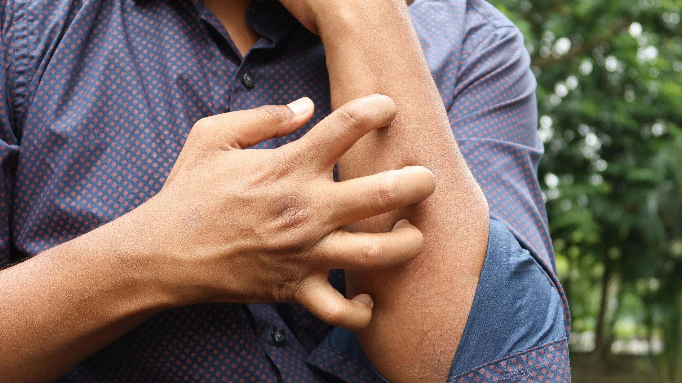 © Towfiqu barbhuiya © Towfiqu barbhuiya