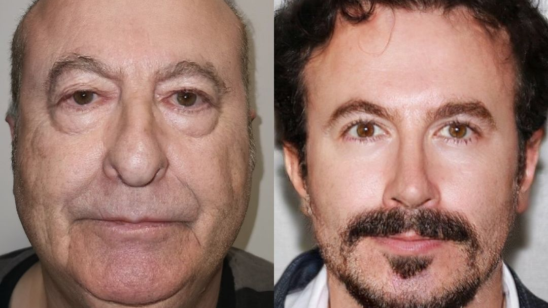 Türkiye'ye geldi, 30 yaş gençleşti!, © webtekno