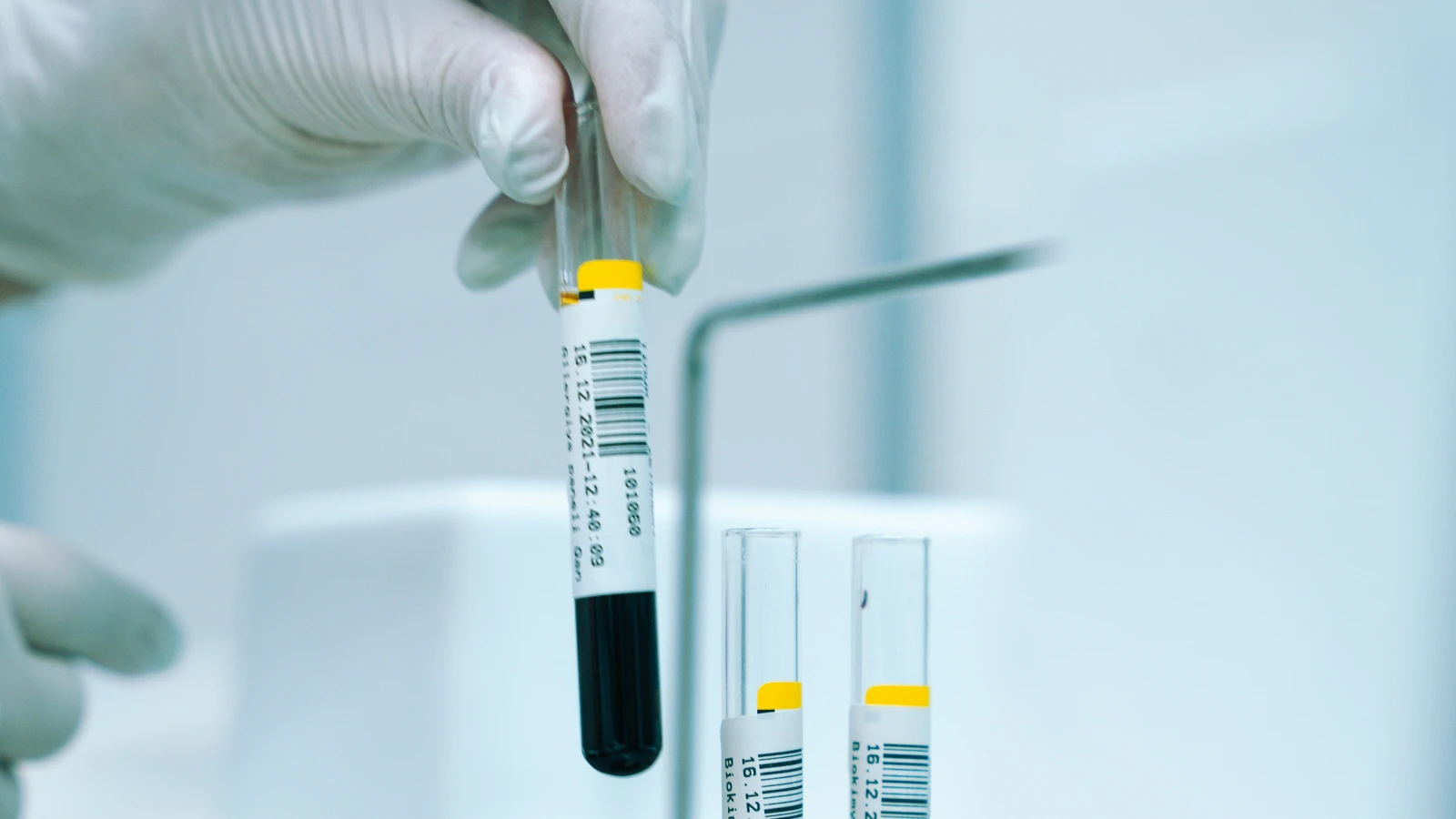 Rotes Kreuz startet Registrierungsaktion , © Akram Huseyn/Unsplash Rotes Kreuz startet Registrierungsaktion , © Akram Huseyn/Unsplash